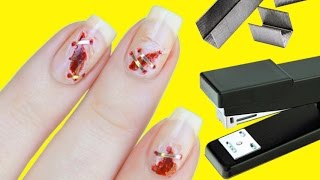 STAPLING MY NAILS BACK TOGETHER ?