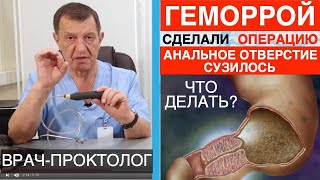 Удалили геморрой. Пневмобаллончики при сужении анального канала после операции на геморрой