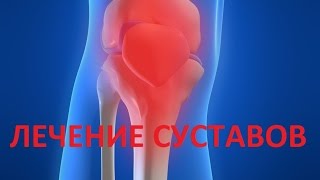 Лечение суставов дешево и эффективно в домашних условиях. Проблема холодных конечностей