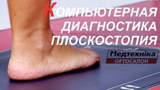 Компьютерная диагностика плоскостопия. Подбор стелек. Профилактика плоскостопия. Диагностика стоп