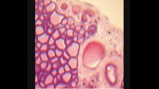 ЩИТОВИДНАЯ ЖЕЛЕЗА. THYROID GLAND. В световой микроскоп.