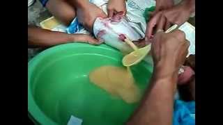 Dopa.vn, Thu Trứng Cá Tra, Cá Basa,  Xử Lý Trứng Dính Cá Tra, Cá Basa, Ấp Trứng Cá Tra, Cá Basa