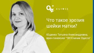 Скажите, доктор…Что такое эрозия шейки матки? Опасна ли она? | «ОН Клиник»