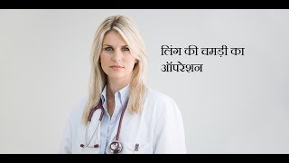 ZSR Circumcision Video  hindi | ling ki chamdi ka operation video | फिमोसिस सर्जरी  दिल्ली इंडिया