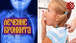 ЛЕЧЕНИЕ БРОНХИТА. Как Вылечить Кашель и Бронхит Народными Средствами