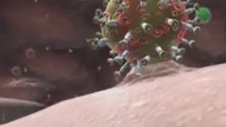 Симптомы и лечение ВИЧ инфекции