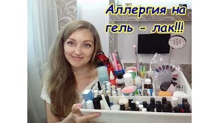 АЛЛЕРГИЯ НА ГЕЛЬ - ЛАК!!! Я ЕЕ ПОБЕДИЛА!!!