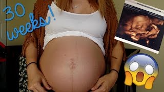 30 WEEKS PREGNANT!- BREECH BABY, 3D ULTRASOUND, NAME REVEAL