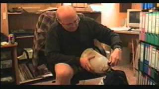 Geronimo's world - male LAK amputee - part 1 from 6