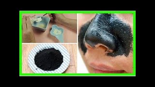 Comment réaliser une pâte adhésive pour éliminer les points noirs du nez