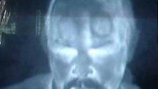 FLIR thermal infrared camera: rings on forehead
