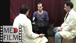 Шизофрения с малой степенью прогредиентности © Schizophrenia is a low degree of progression
