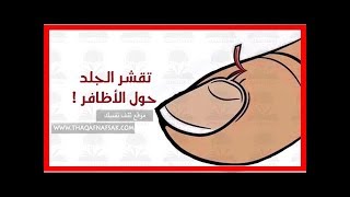 أسباب جفاف وتقشر الجلد حول الأظافر وكيفية علاجه