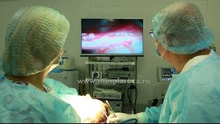 Эндоскопическая подтяжка лба и пластика нижних век