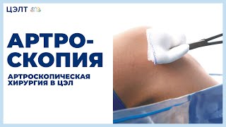 Артроскопия. ?Артроскопическая хирургия в ЦЭЛТ.