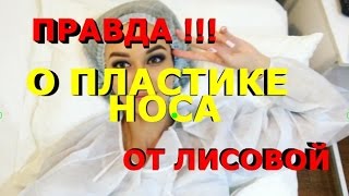 Ринопластика Носа Мои ощущения До и После Пластики Носа  Отзыв