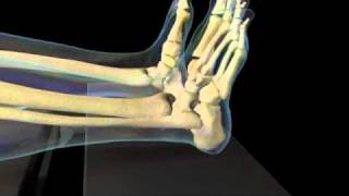 HyProCure® Animation - Learn more about HyProCure® and how it works