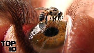 Top 10 Most Painful Experiences In The World