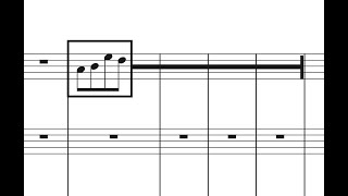 Aeleatoric Box Notation (Wheel) | Finale Superuser