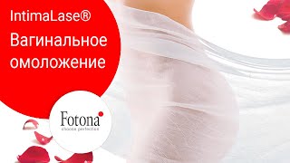 IntimaLase - интимное омоложение и безоперационное лечение опущения стенок влагалища