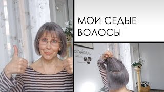 СЕДЫЕ ВОЛОСЫ 14 МЕСЯЦЕВ