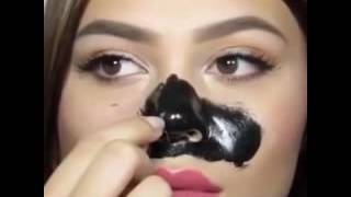 Black &Amp; White Heads On Nose Part 3 - Черные Прыщи