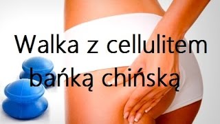 Bańki chińskie - idealny pogromca cellulitu i nie tylko