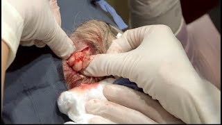 Bon appétit bien sûr ! - Docteur Pimple Popper