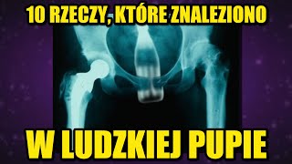 10 rzeczy, które znaleziono w ludzkim tyłku [Jacek Makarewicz]