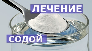 Успешно лечит рак,опухоли,лямблий,аскарид сода пищевая.