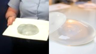 Man Brings Breast Implant to Police As Crime Evidence But It's Actually Jellyfish