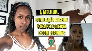 ESFOLIANTE CASEIRO PARA PELE OLEOSA E COM ESPINHAS - COM UM SÓ PRODUTO BARATINHO | Izabel Bastos