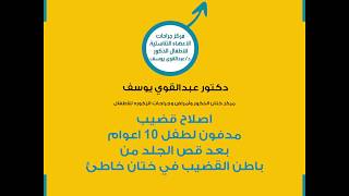 إصلاح #الطهاره #الختان#قضيب #مدفون بسبب قص الجلد من باطن القضيب بالكامل دكتور #عبدالقوي يوسف
