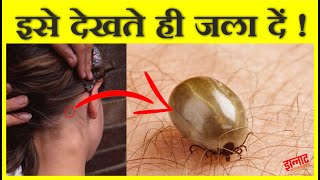 जहाँ भी ये कीड़ा दिखा इसे जला दो | Ticks that suck blood and contain viruses