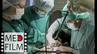 Пересадка сердца. 2 фильма (Германия) © Heart transplantation. 2 films (Germany)