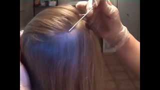 How to check for head lice