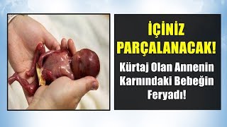Bebeğin Kurt-aj Olurken Annesi İle Konuşması İÇİNİZİ PARÇALAYAN İBRETLİK HİKAYE - Can Demiryel