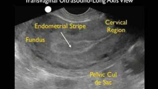 Ectopic Pregnancy Case Study - Part 1