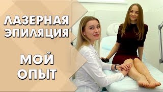 Лазерная эпиляция | Мой опыт удаления волос | Индустрия Здоровья