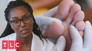 Paul's Huge Foot Lump | My Feet Are Killing Me