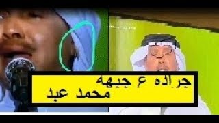 لقطة مضحكة مع محمد عبده في حفلة القصيم جرادة على جبهته - جراده محمد عبده