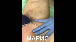 Мужское глубокое бикини. Часть 1