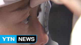 '실명 3대 원인' 녹내장, '노년병?'...20~30대도 '위험!' / YTN (Yes! Top News)