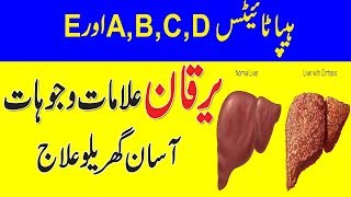 Hepatitus A, B, C, D, E Symptoms , Causes And Treatment In Urdu/Hindi | Tib E Nabvi Se Ilaj