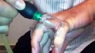 Cupping Lesson 2 الحجامه: Bending the Cup & Cupping the Fingers