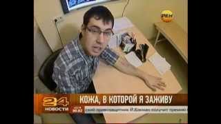 Искусственная кожа