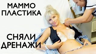 СНИМАЮТ ДРЕНАЖИ ПОСЛЕ ОПЕРАЦИИ | Маммопластика моя история | Мой опыт увеличения груди