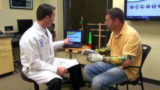i-limb ultra Bionic Hand Moves Like Human Hand, Helps Arm Amputees Regain Dexterity