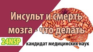 Как восстановить и лечить мозг после инсульта? ✓ Что происходит с мозгом после инсульта?