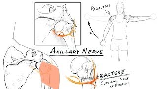 The Brachial Plexus II: Animated Review [HD]